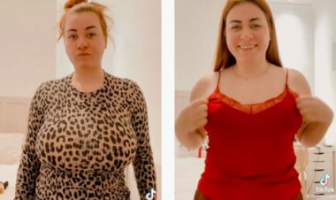 Kugabanyisha  amabere ye byatumye agurisha isambu