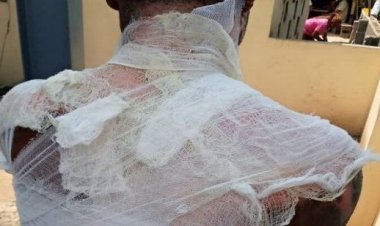 Nigeria: Umugore yicishije umugabo we amazi ashyushye ubwo yari asinziriye