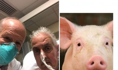 Wa mugabo bashyizemo umutima w’ingurube yitabye Imana