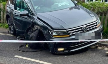 Bruno Fernandes yakoze impanuka Imana ikinga ukuboko