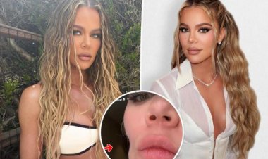Amafoto ya Khloe Kardashian yateye abafana be amarangamitima