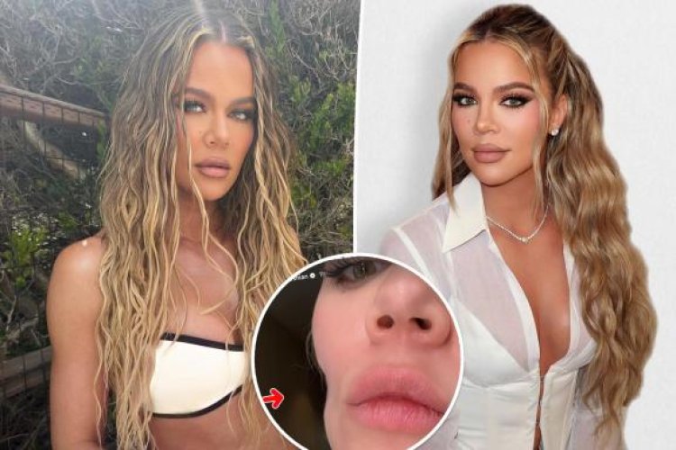 Amafoto ya Khloe Kardashian yateye abafana be amarangamitima