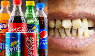 Ibinyobwa bitanu bishobora kukwangiriza amenyo