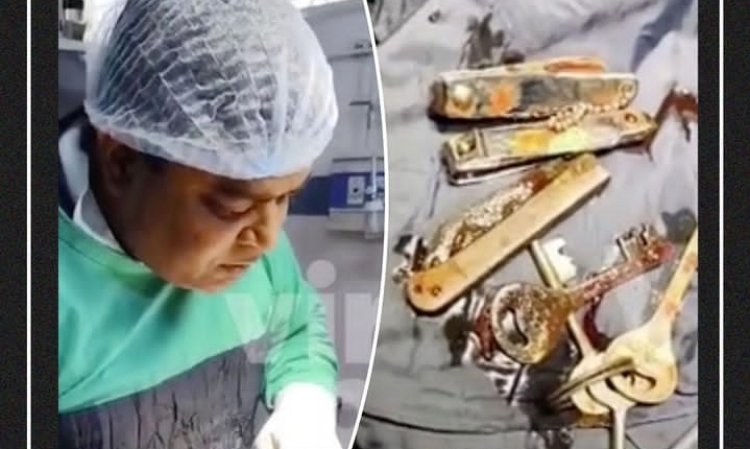 Yakuwe imisumari n'ifunguzo mu nda