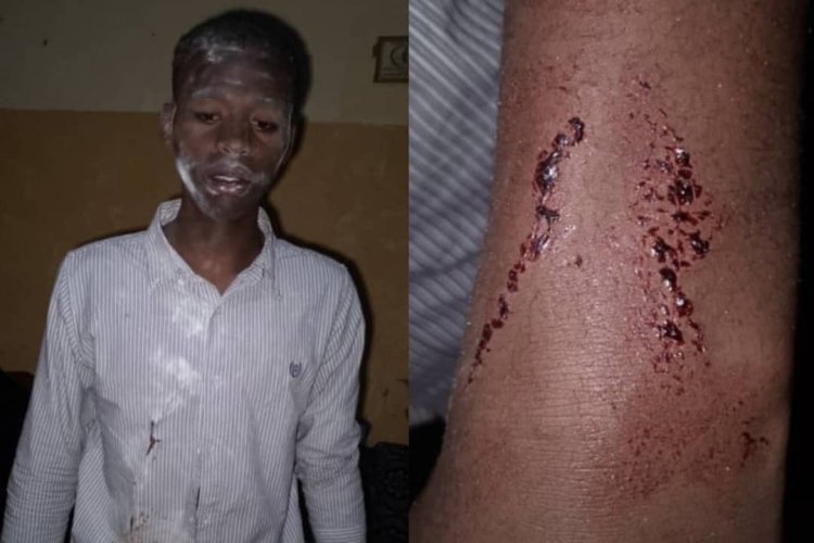 Umunyeshuri wa Kaminuza afungiwe kubeshya ko yashimuswe agasaba ibihumbi 100Rwf