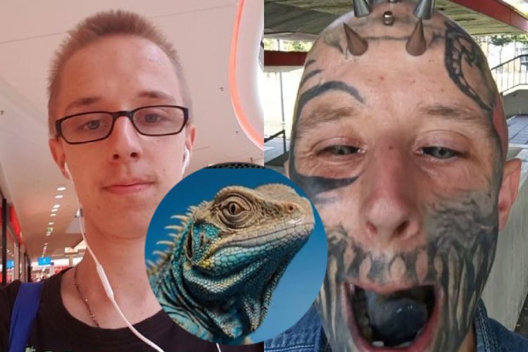 Akomeje kuvugisha benshi nyuma yo kwibagisha ngo ase n'umuserebanya